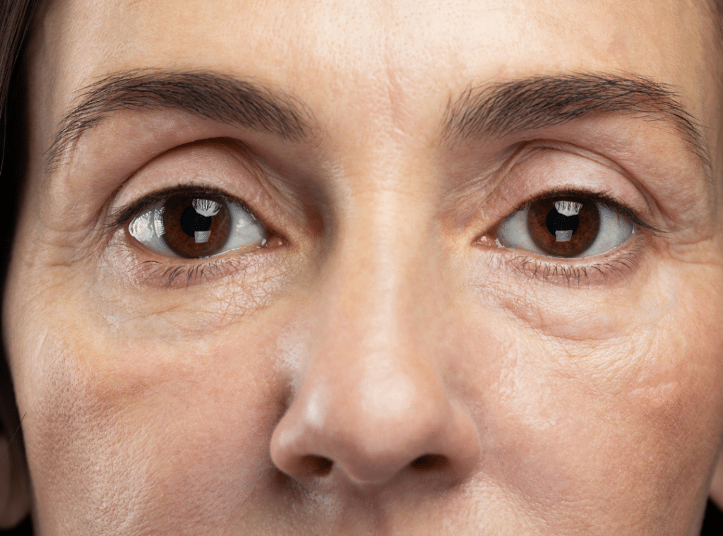 how to reverse aging eyes